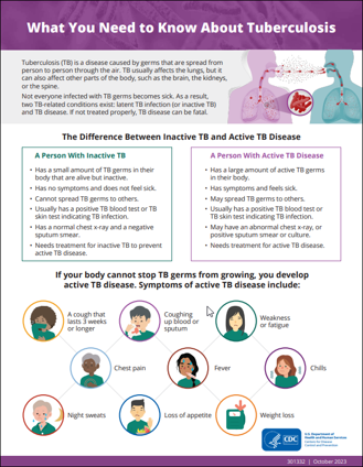 What You Need to Know About Tuberculosis 