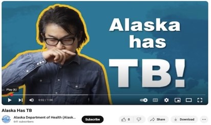 Alaska Has TB