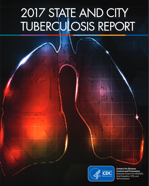 2017 State and City Tuberculosis Report