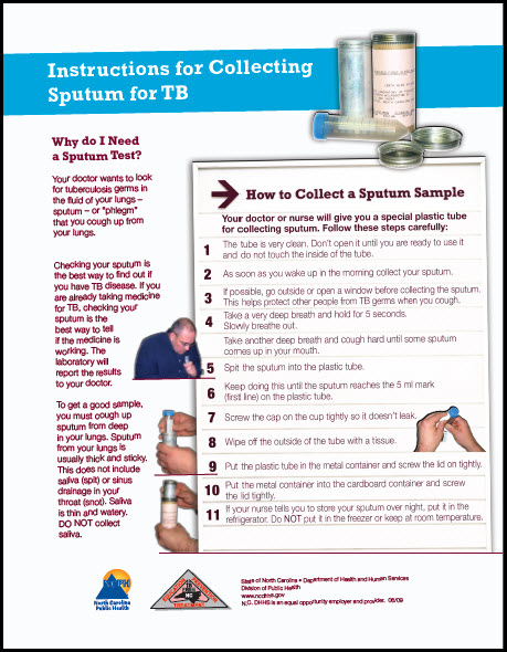 Instructions for Collecting Sputum for a TB Test