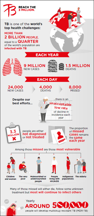 Global TB Burden Infographic