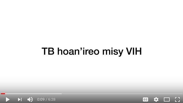 TB in those with HIV in Malagasy (Madagascar)