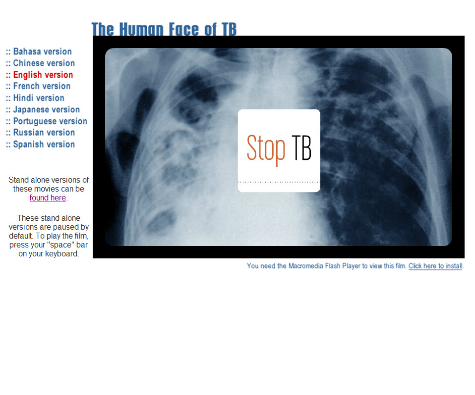 The Human Face of TB