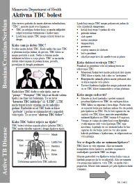 Aktivna TBC bolest[[Active TB Disease]]
