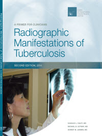 Radiographic Manifestations of Tuberculosis: A Primer for Clinicians