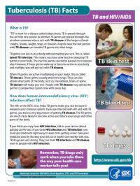 TB and HIV/AIDS Fact Sheet