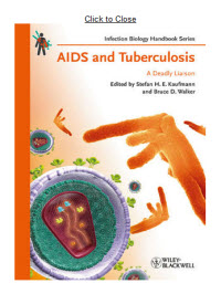 AIDS and Tuberculosis: A Deadly Liaison