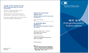 폐외 결핵 [Extrapulmonary Tuberculosis]