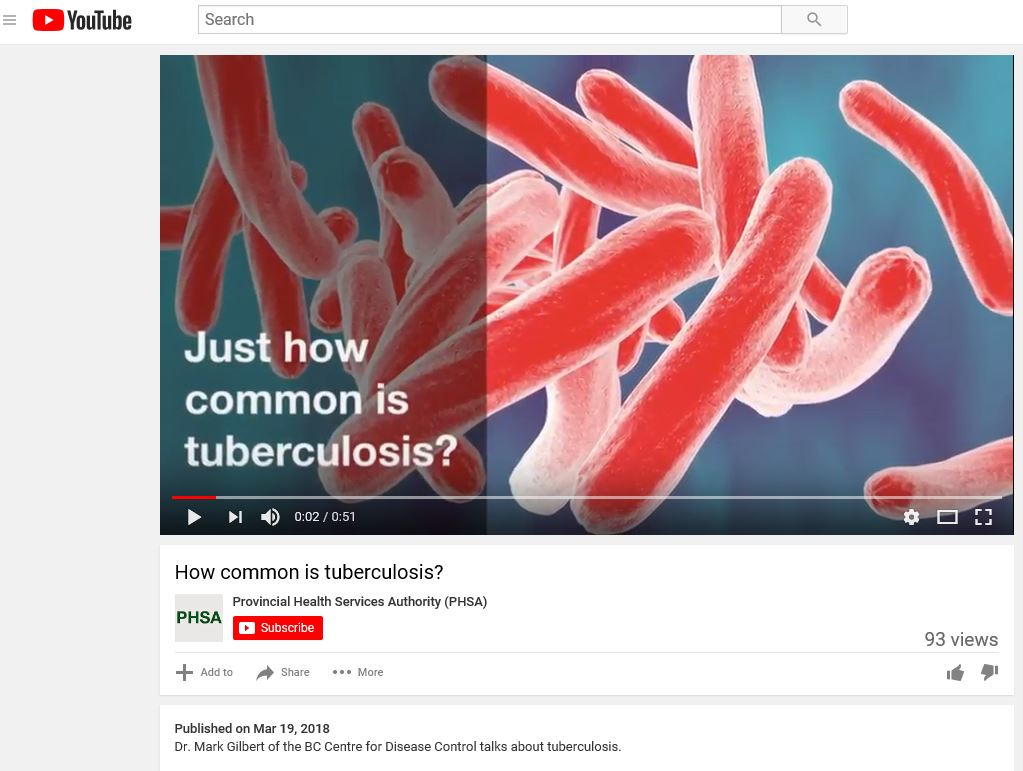 How Common is Tuberculosis? Video