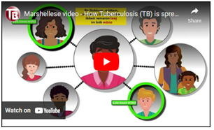Marshellese video - How Tuberculosis (TB) is spread?