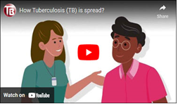 How Tuberculosis (TB) is spread?