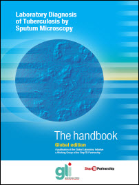 Laboratory Diagnosis of Tuberculosis by Sputum Microscopy