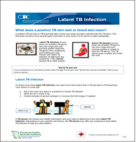 Latent TB Infection