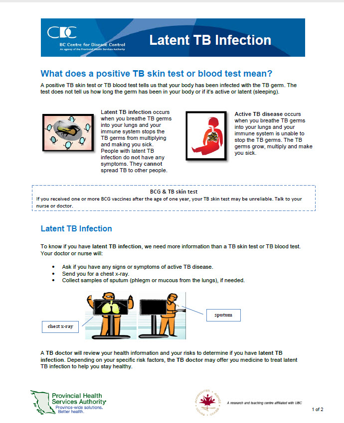 Latent TB Infection Fact Sheet