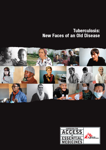 Tuberculosis: New Faces of an Old Disease