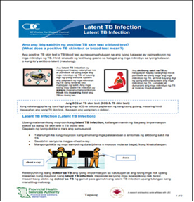 Latent TB Infection