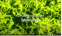 Tuberculosis Contact Investigation