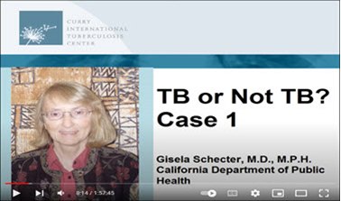 TB? Maybe Not: The Differential Diagnosis of Tuberculosis