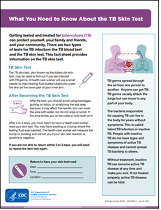 What You Need to Know About the TB Skin Test