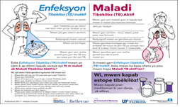 You Can Prevent Tuberculosis: A Patient Educational Handout 