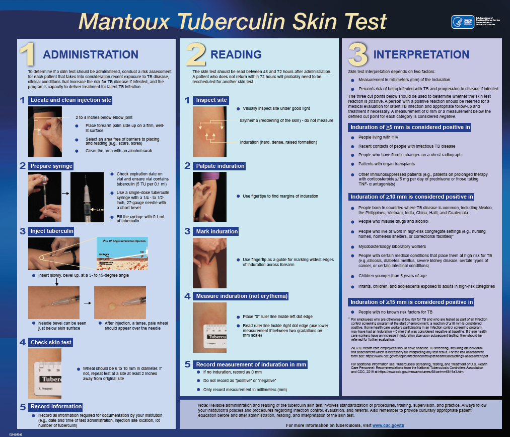 The Mantoux Tuberculin Skin Test Wall Chart