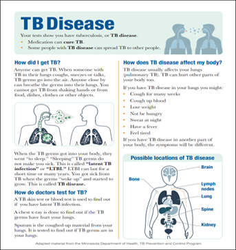 Active TB Disease Fact Sheet (Multi-Language)