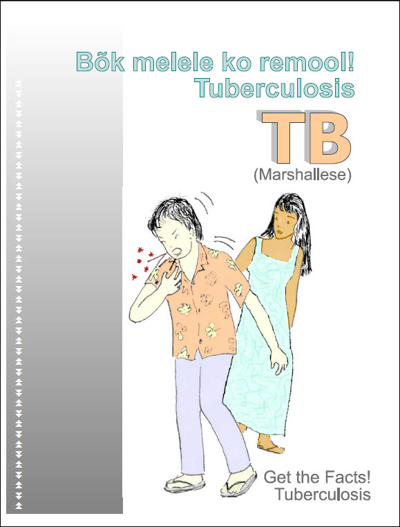 Tuberculosis: Get The Facts | National Prevention Information Network ...