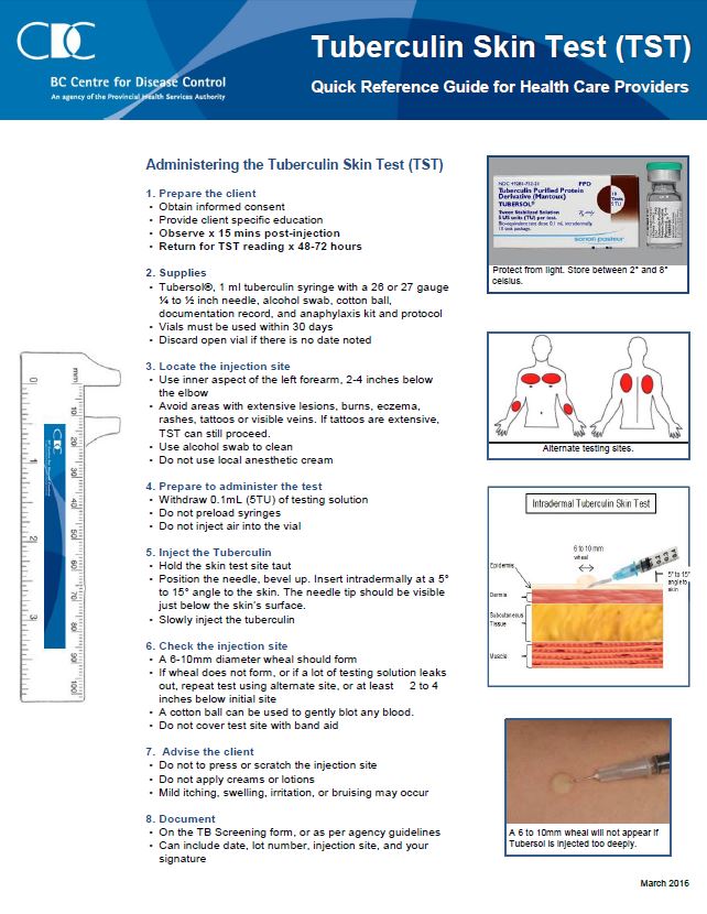 udelukkende Numerisk ufravigelige Tuberculin Skin Test (TST) Quick Reference Guide for Health Care Providers  | National Prevention Information Network | Connecting public health  professionals with trusted information and each other