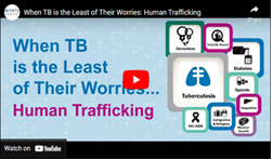 When TB is the Least of Their Worries: Human Trafficking. Go to webinar 