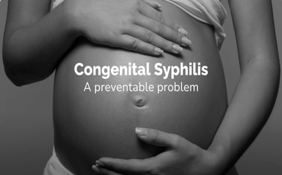 Congenital Syphilis A Preventable Problem (Web)