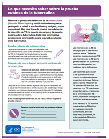 Lo que necesita saber sobre la prueba cutánea de la tuberculina [What You Need to Know About the TB Skin Test]. Go to fact sheet