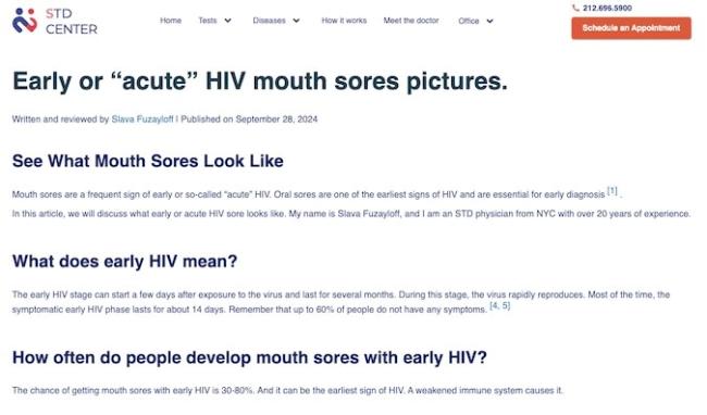 Early or “Acute” HIV Mouth Sores Pictures. (Web)