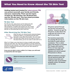 What You Need to Know About the TB Skin Test (PDF) 