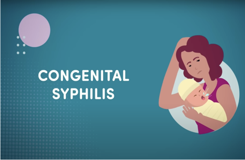 Congenital Syphilis: A Growing Problem (Web)