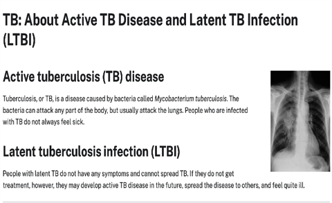 TB: About Active TB Disease and Latent TB Infection (LTBI) (Web)