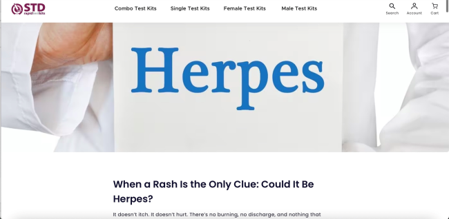 When a Rash Is the Only Clue: Could It Be Herpes? (URL)