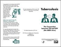 Thumbnail image of Tuberculosis: The Connection Between TB and HIV (the AIDS Virus) 