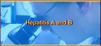 Thumbnail image of Hepatitis A and B 