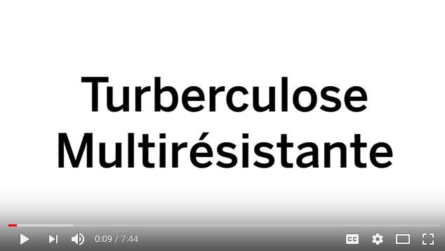  Drug-Resistant Tuberculosis in French (Congo) 
