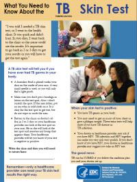  Cosas Que Debe Saber Sobre La Prueba De La Tuberculina[What You Need to Know About the TB Skin Test] 