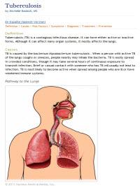  Tuberculosis 