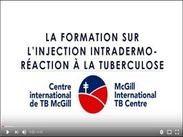 La Formation Sur L’injection Intradermo- Réaction À La Tuberculose [TB Skin Test Training for Heath Care Workers]. Go to video