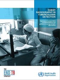  Chest Radiography in Tuberculosis Detection 