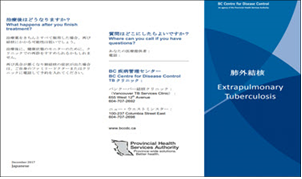 [Extrapulmonary Tuberculosis]. Go to brochure