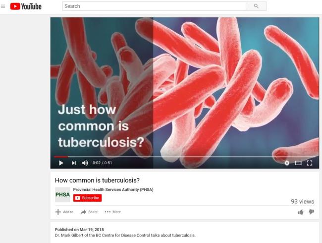  How Common is Tuberculosis? Video 