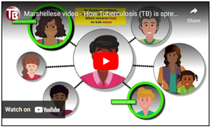 Marshellese Video - How Tuberculosis (TB) is spread?. Go to video