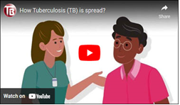 How Tuberculosis (TB) is spread? Go to video
