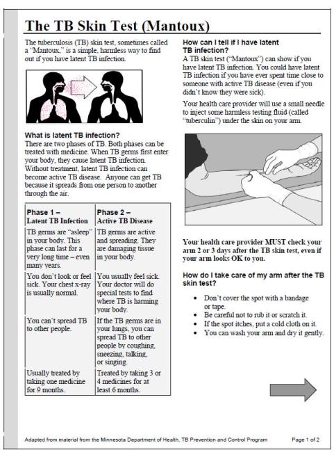 TB Skin Test Fact Sheet (Multi-Language) 