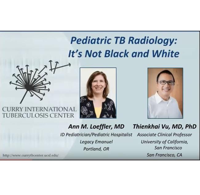  Pediatric TB Radiology: It's Not Black and White 