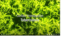 TB Contact Investigation. Go to video